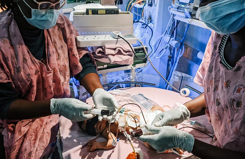 Two medical professionals perform an exchange transfusion on a baby.