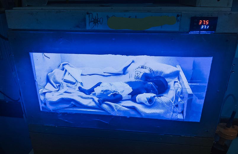 A baby lies in a see-through box while receiving phototherapy