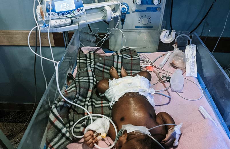 An infant on a ventilator